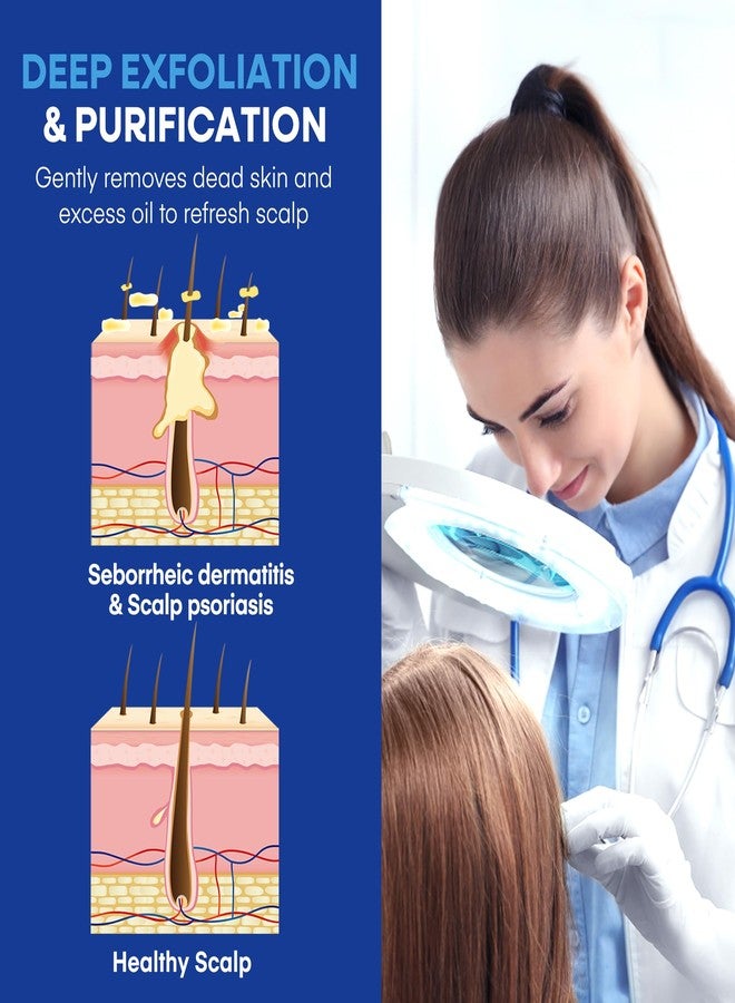 Hermon Medicated Shampoo for Scalp Seborrheic Dermatitis & Psoriasis: Plant-Based Formula Soothes Itch, Reduces Flakes, Supports Hair Health & Deep Cleansing Treatment for man and women 300ml/10.0fl oz - Image 5